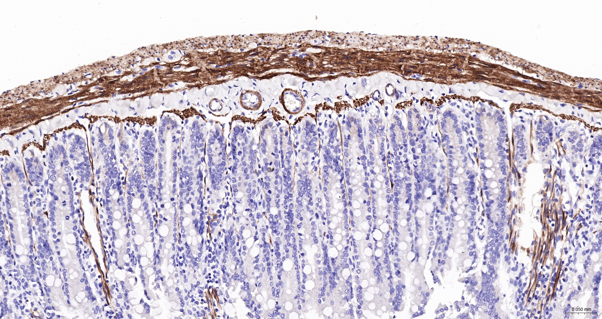 CNN1 Recombinant Antibody, Biotin Conjugated