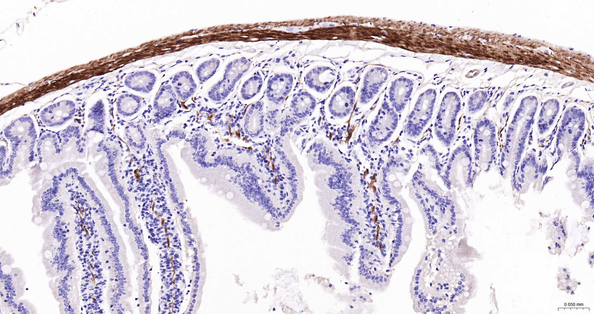 CNN1 Recombinant Antibody, Biotin Conjugated