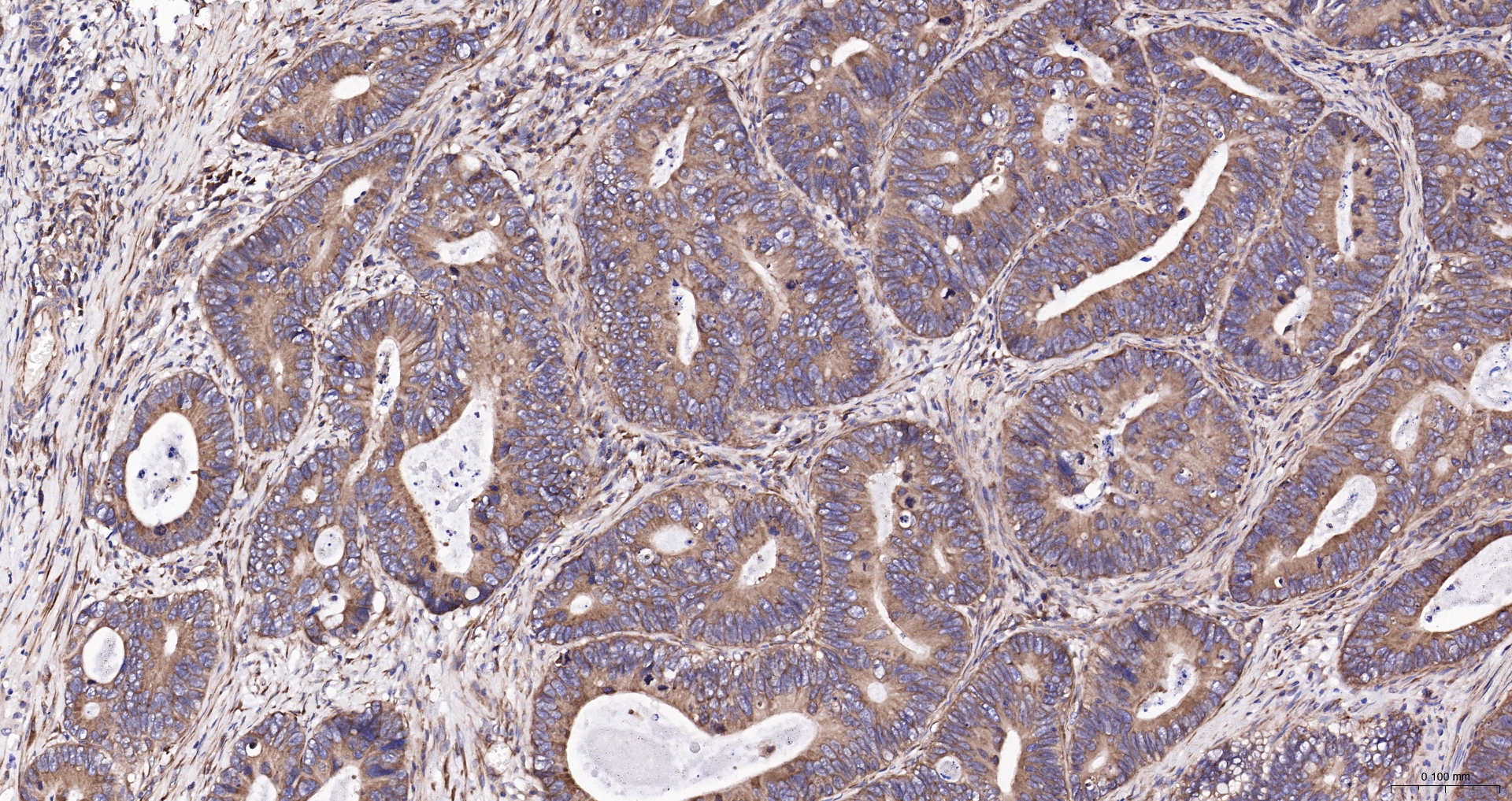 DDIT3 Polyclonal Antibody, Biotin Conjugated