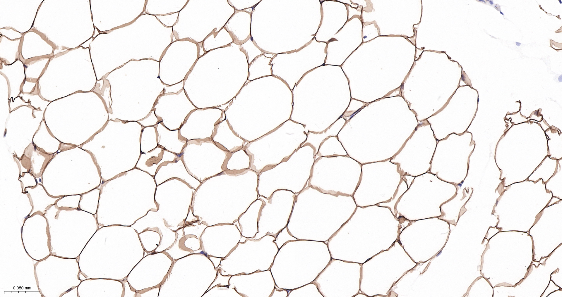 Leptin Monoclonal Antibody