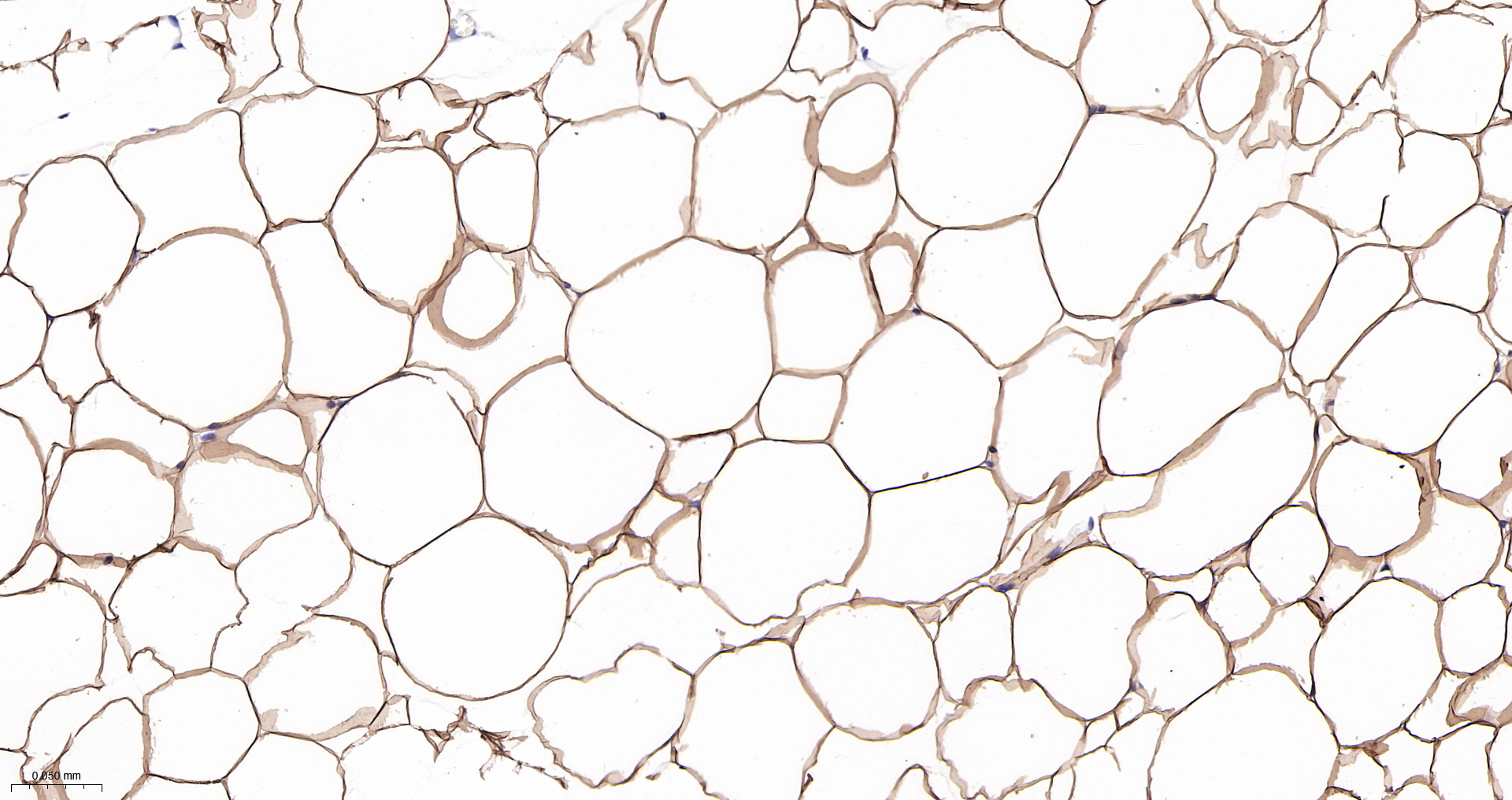 Leptin Monoclonal Antibody