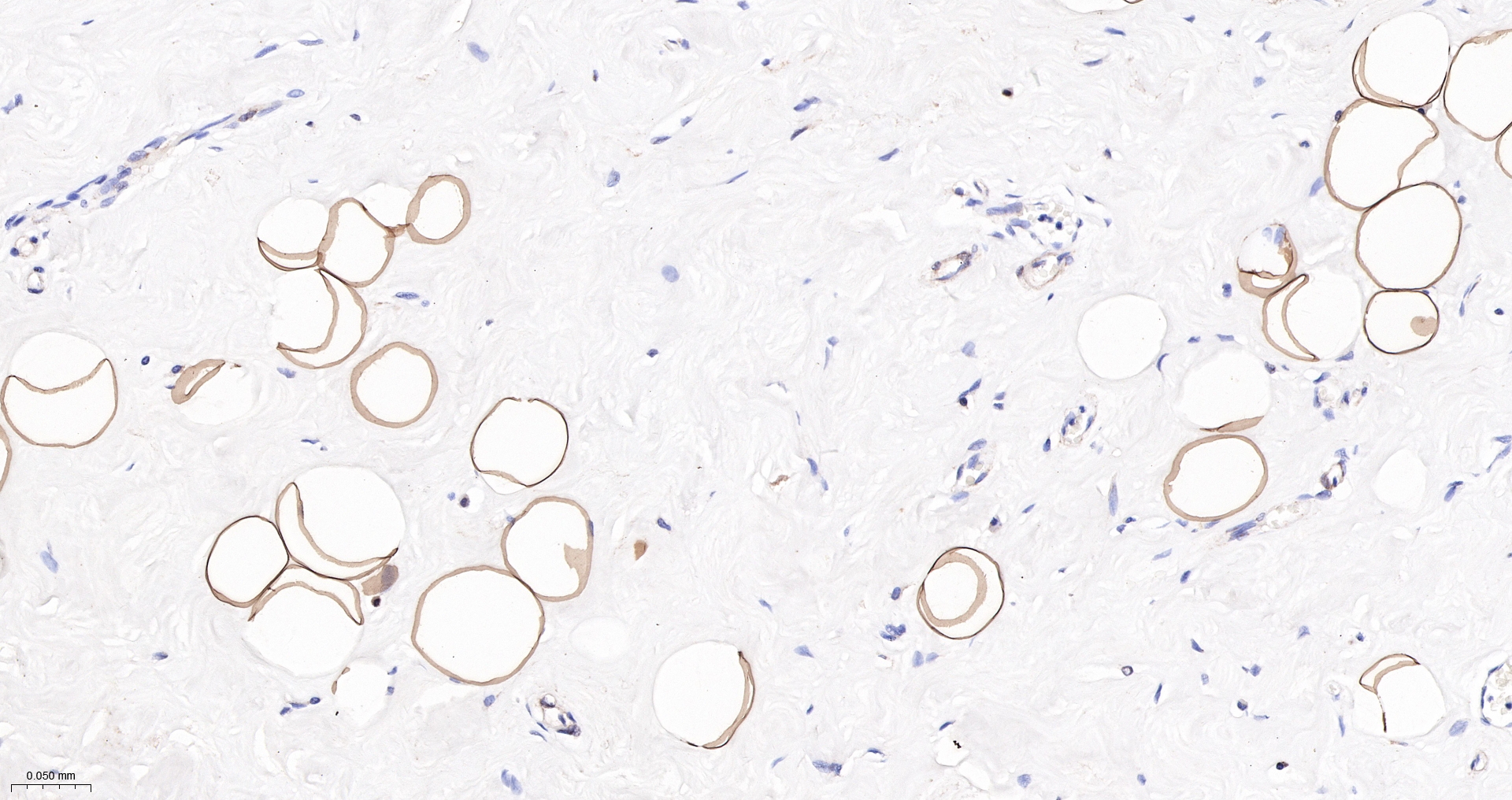 Leptin Monoclonal Antibody