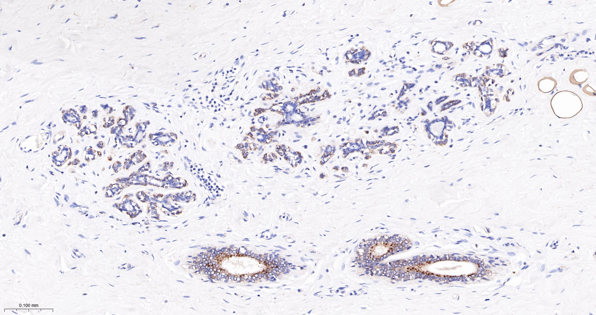 Leptin Monoclonal Antibody