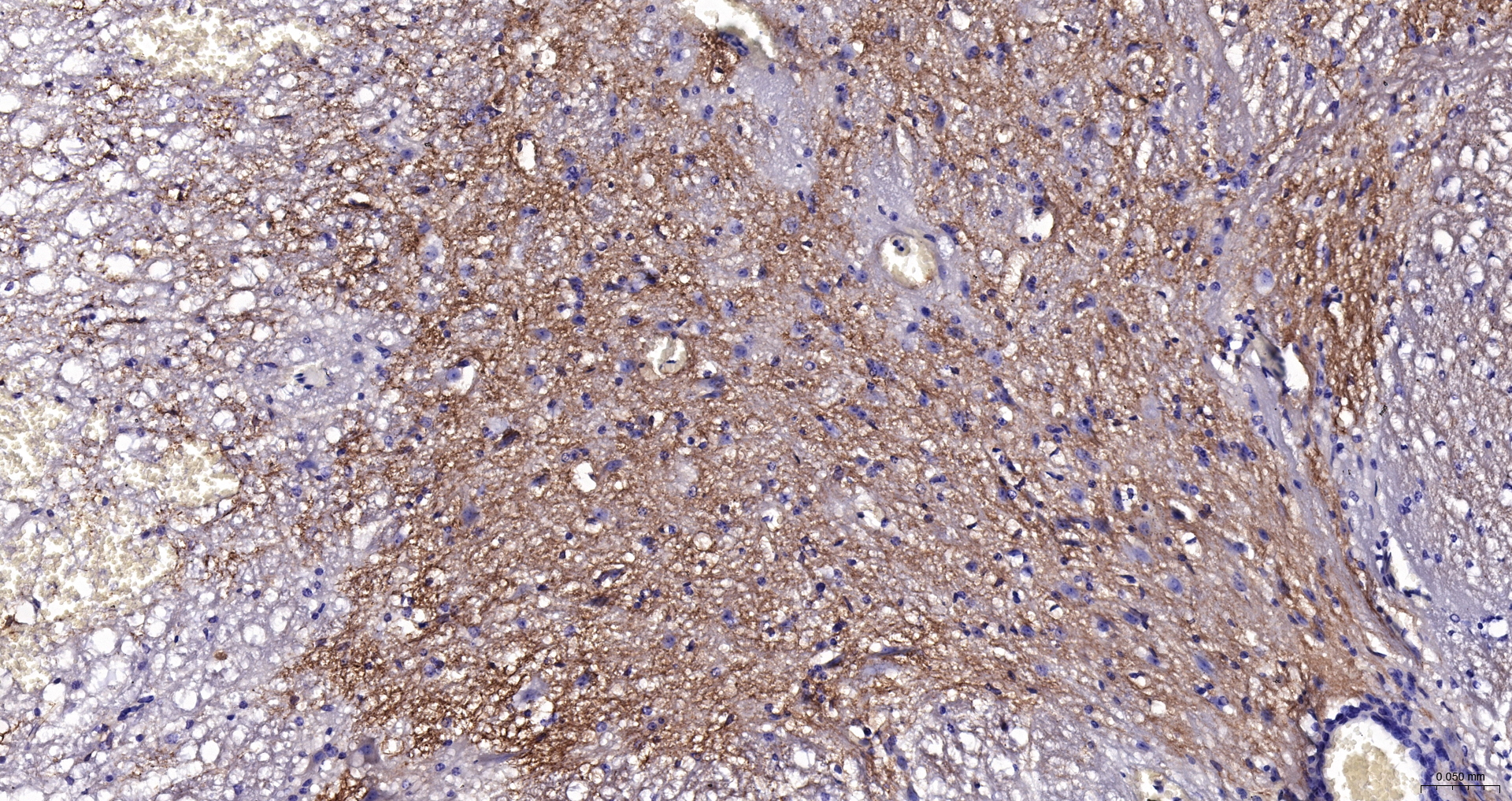 EAAT2 Polyclonal Antibody, Biotin Conjugated