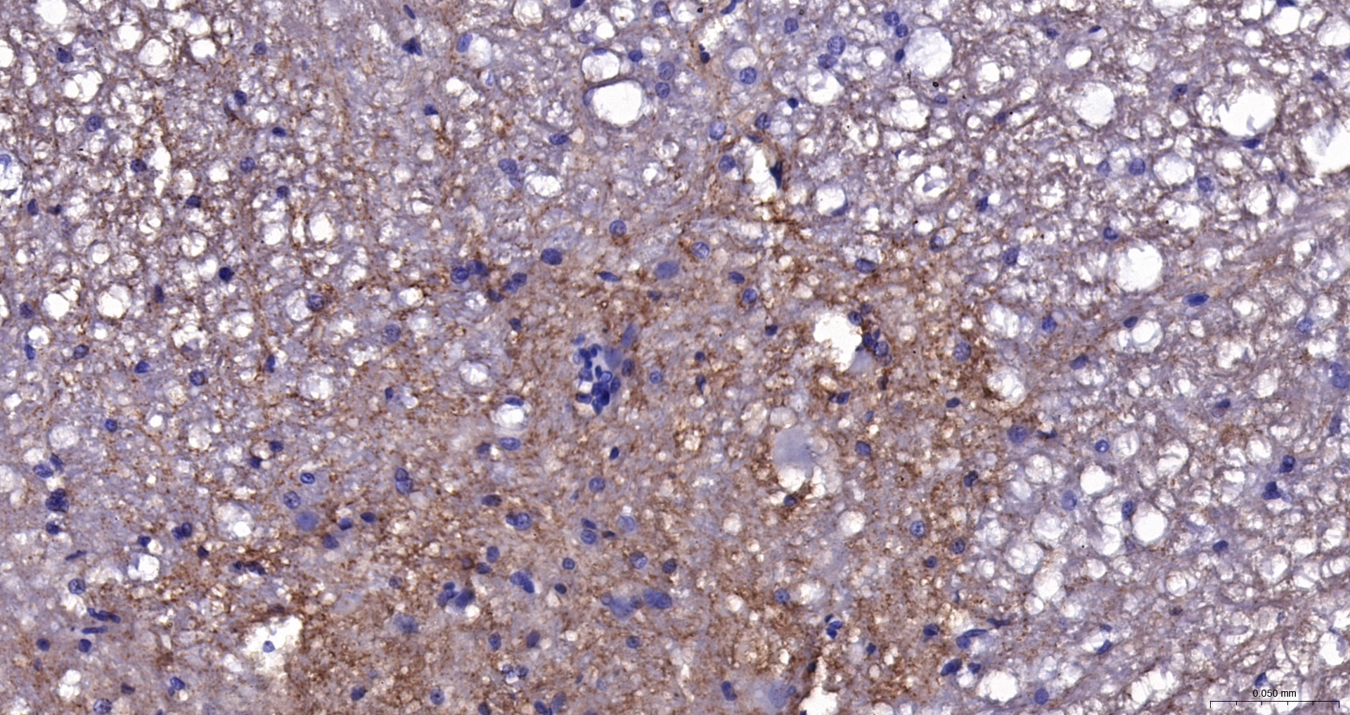 EAAT2 Polyclonal Antibody, Biotin Conjugated