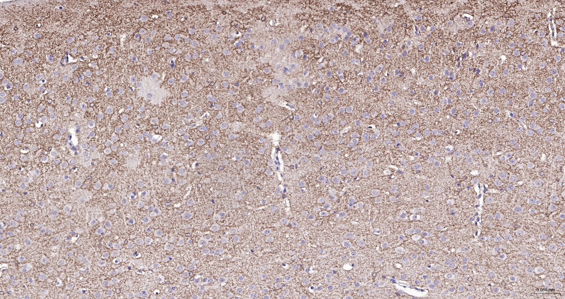 EAAT2 Polyclonal Antibody, Biotin Conjugated