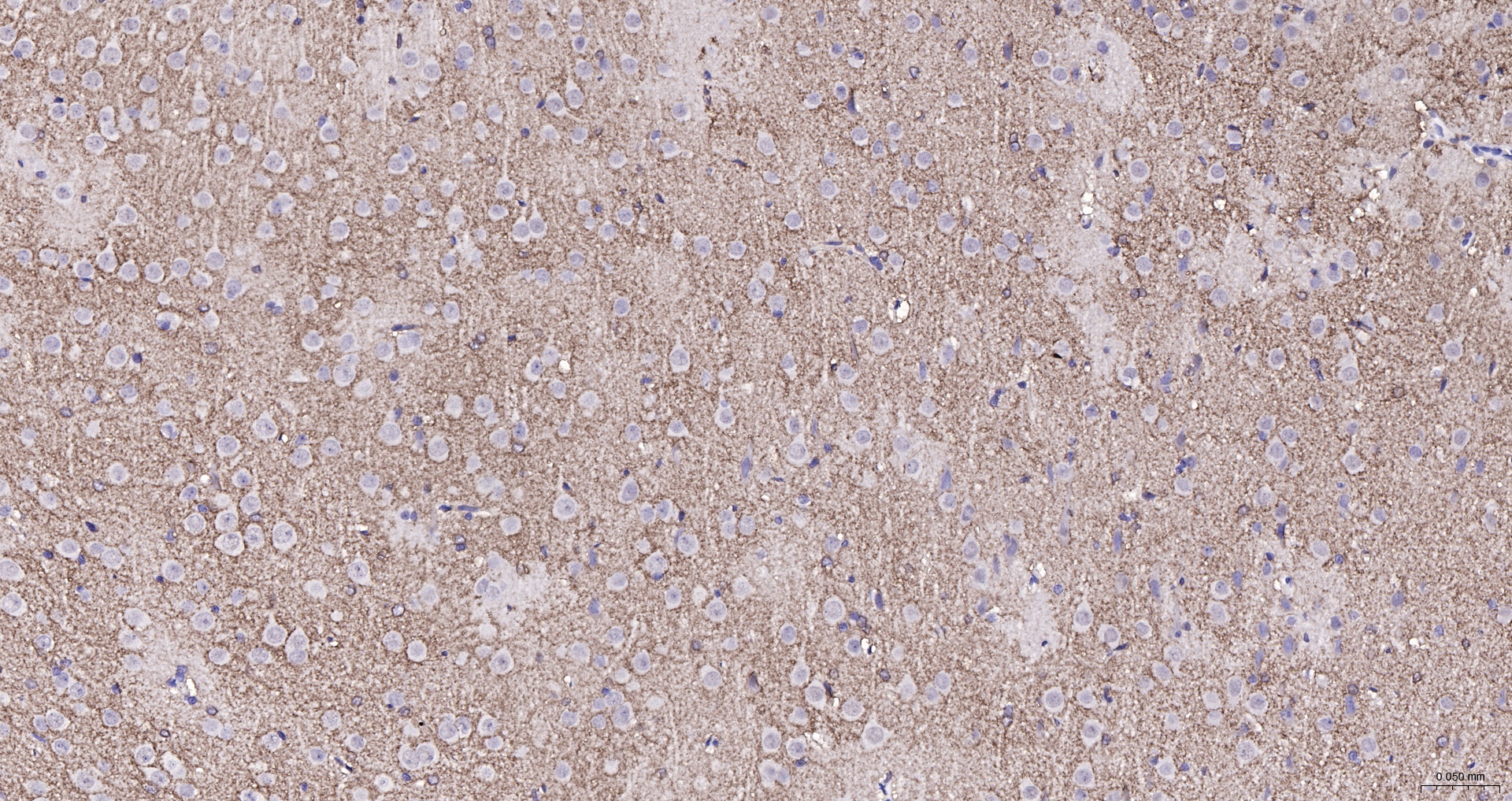 EAAT2 Polyclonal Antibody, Biotin Conjugated