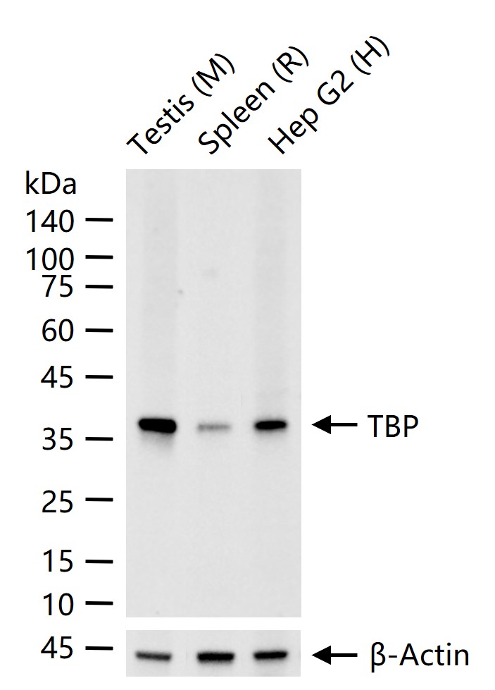TBP Recombinant Antibody