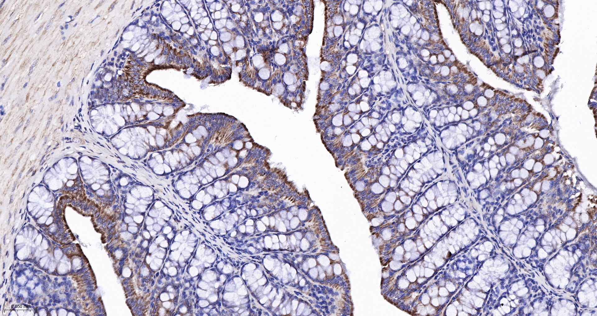 CPT1A Monoclonal Antibody