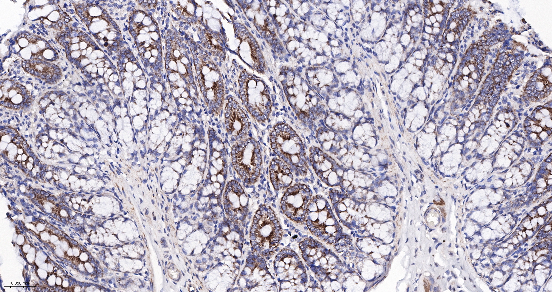 CPT1A Monoclonal Antibody