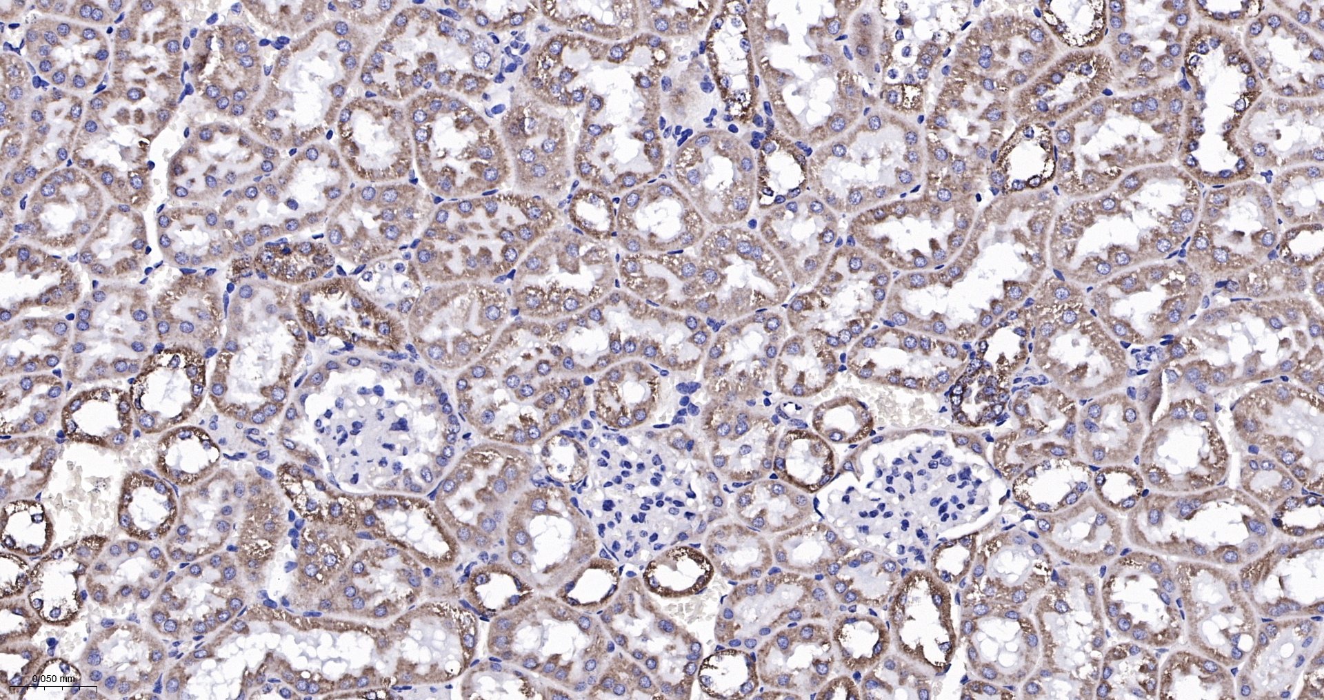 CPT1A Monoclonal Antibody