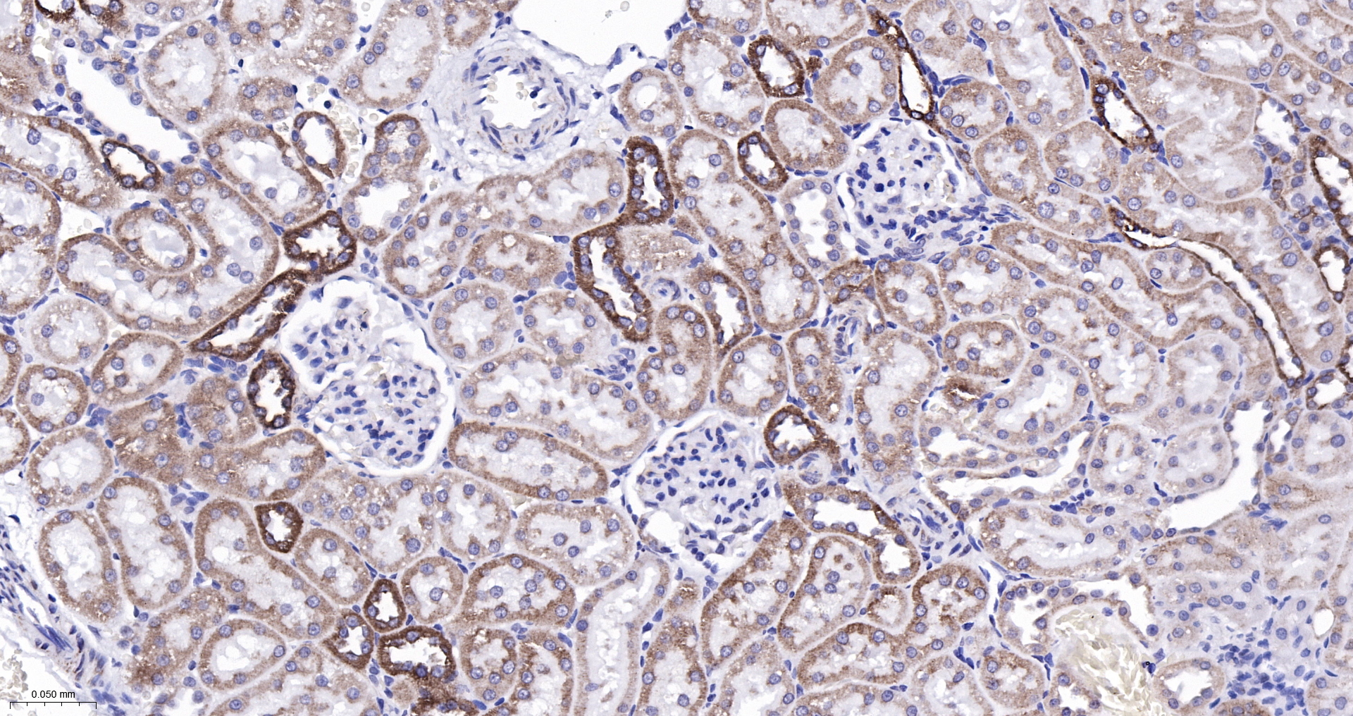 CPT1A Monoclonal Antibody