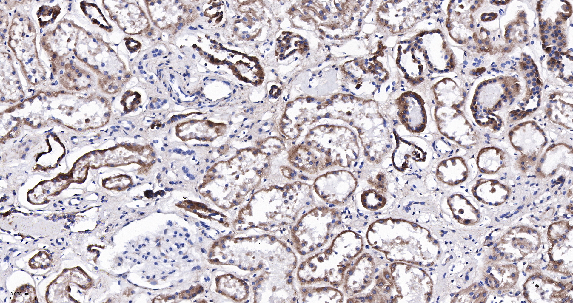 CPT1A Monoclonal Antibody
