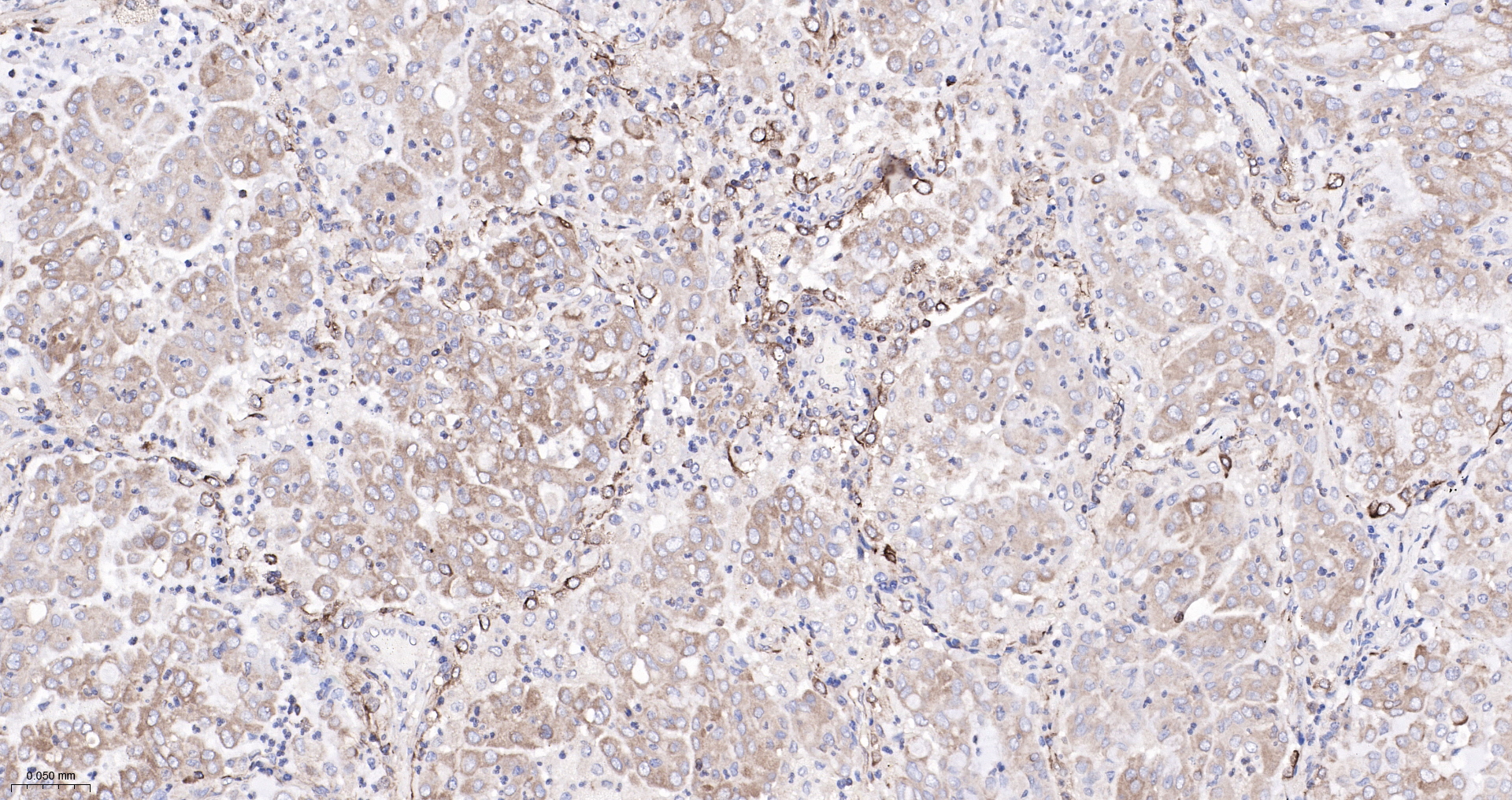 ADAM15 Recombinant Antibody