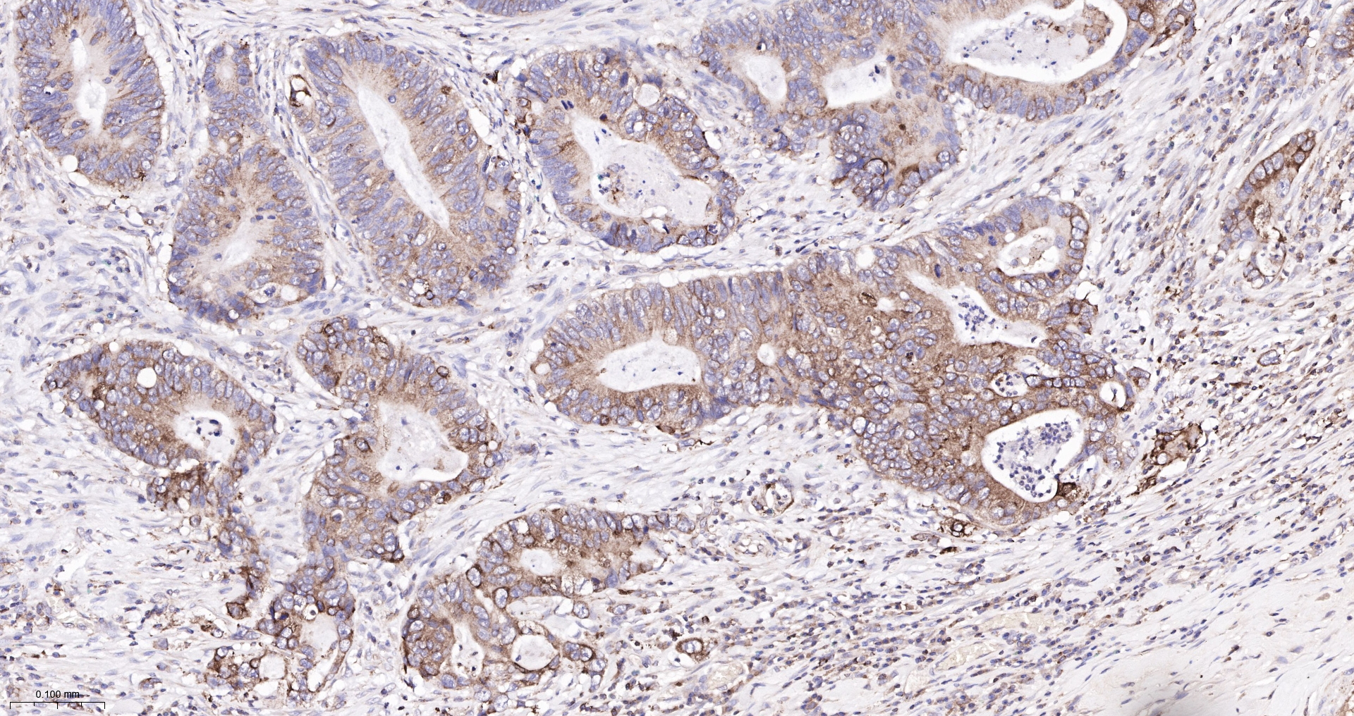 ADAM15 Recombinant Antibody