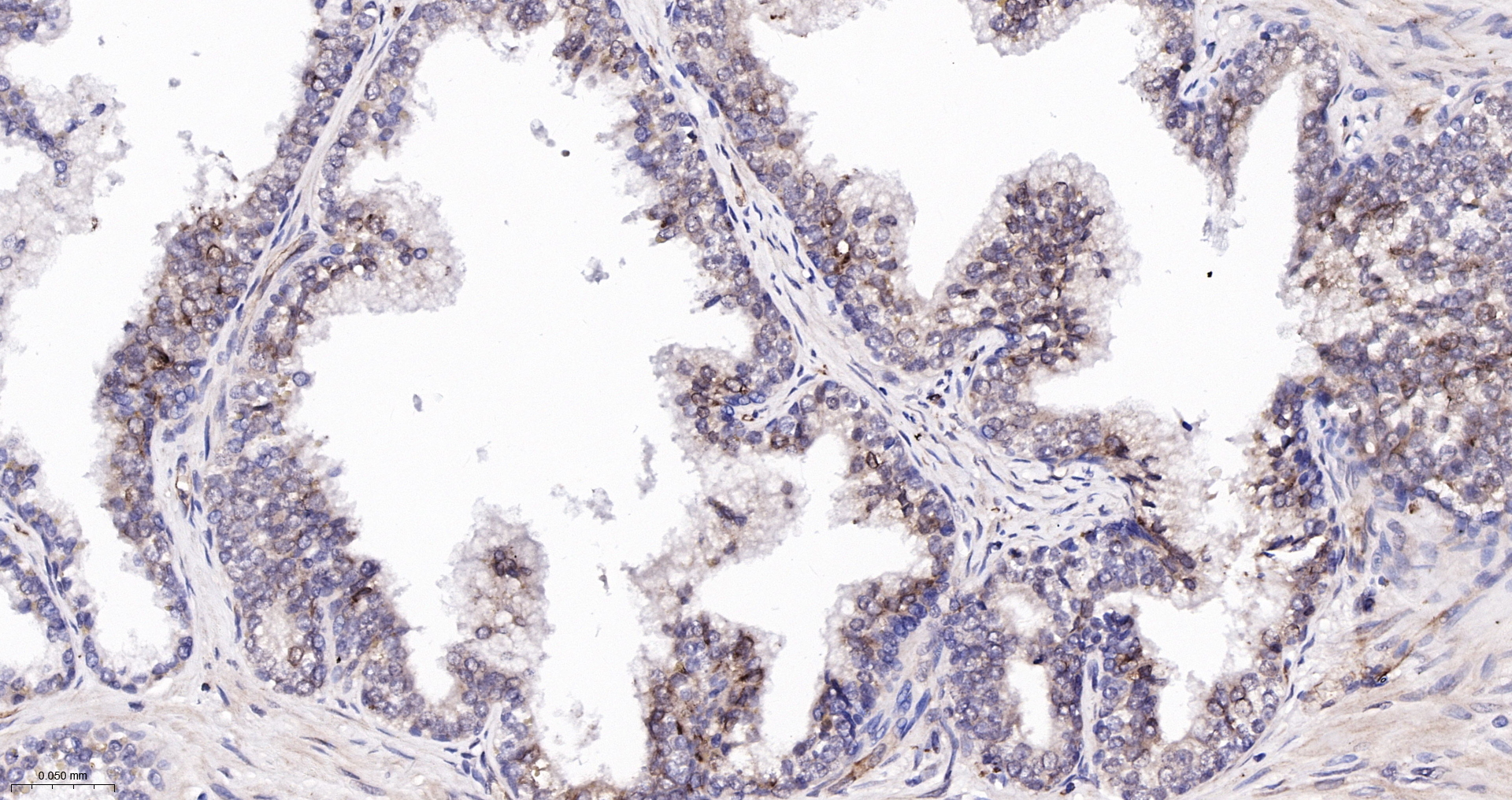 ADAM15 Recombinant Antibody