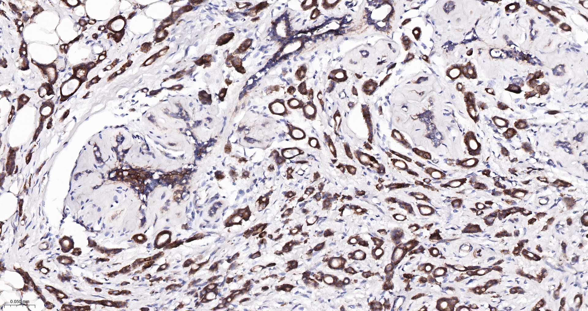 ADAM15 Recombinant Antibody
