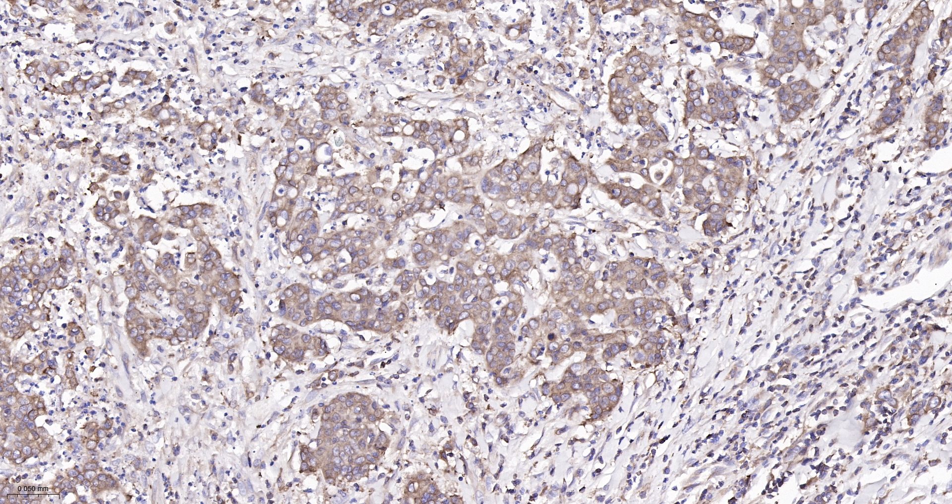 ADAM15 Recombinant Antibody
