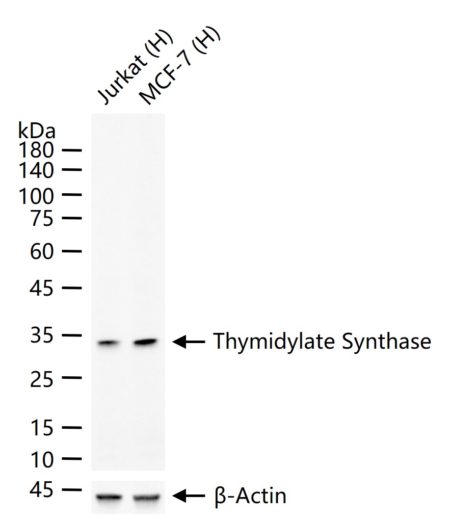 Thymidylate Synthase Recombinant Antibody