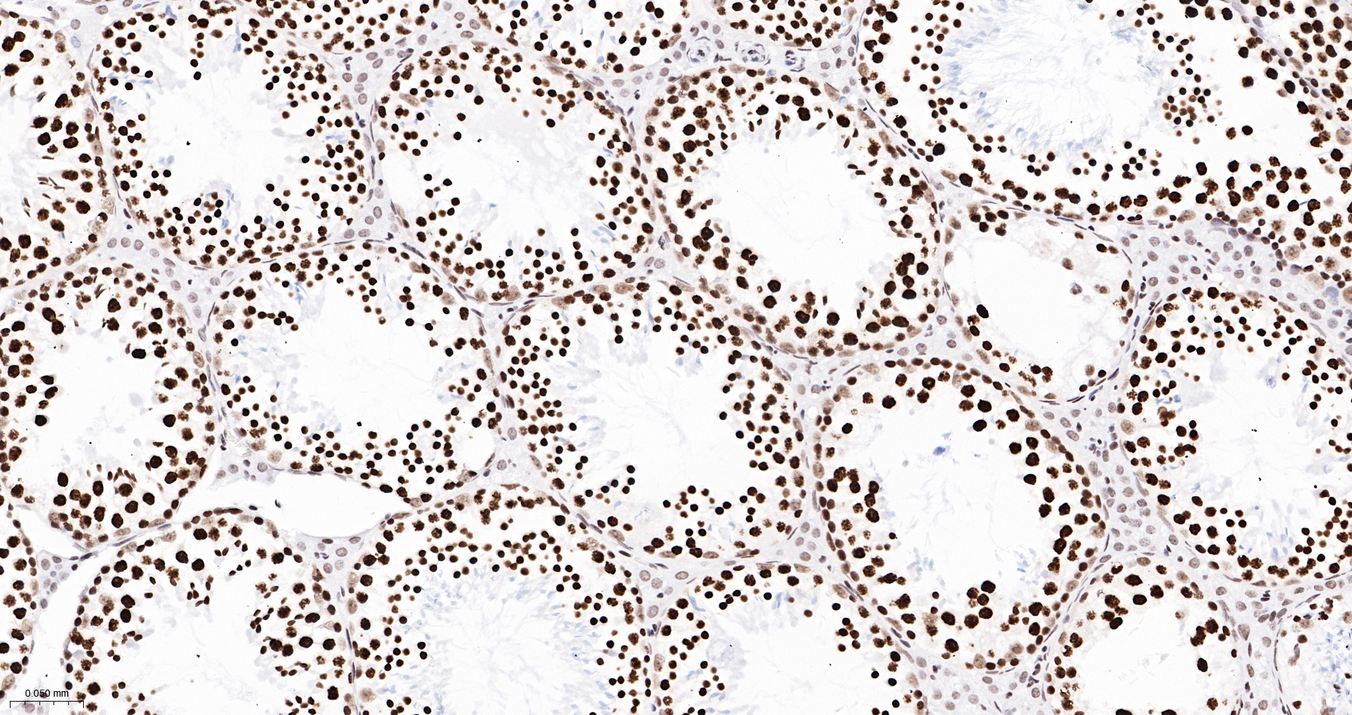 TBP Recombinant Antibody