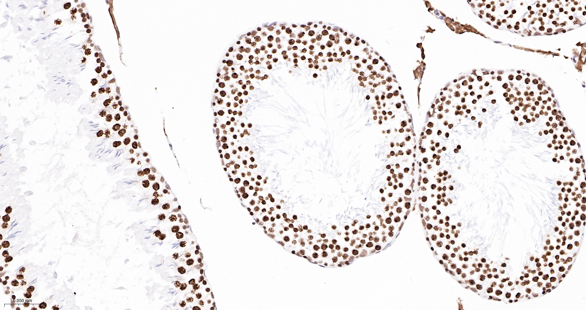 TBP Recombinant Antibody