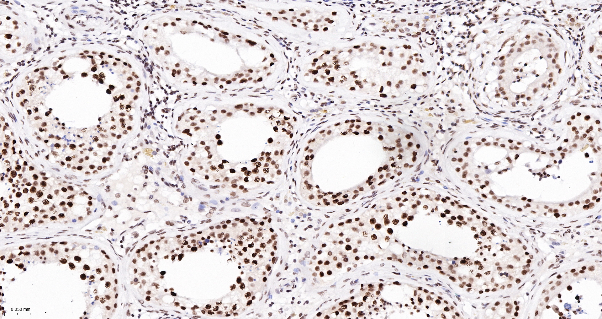 TBP Recombinant Antibody