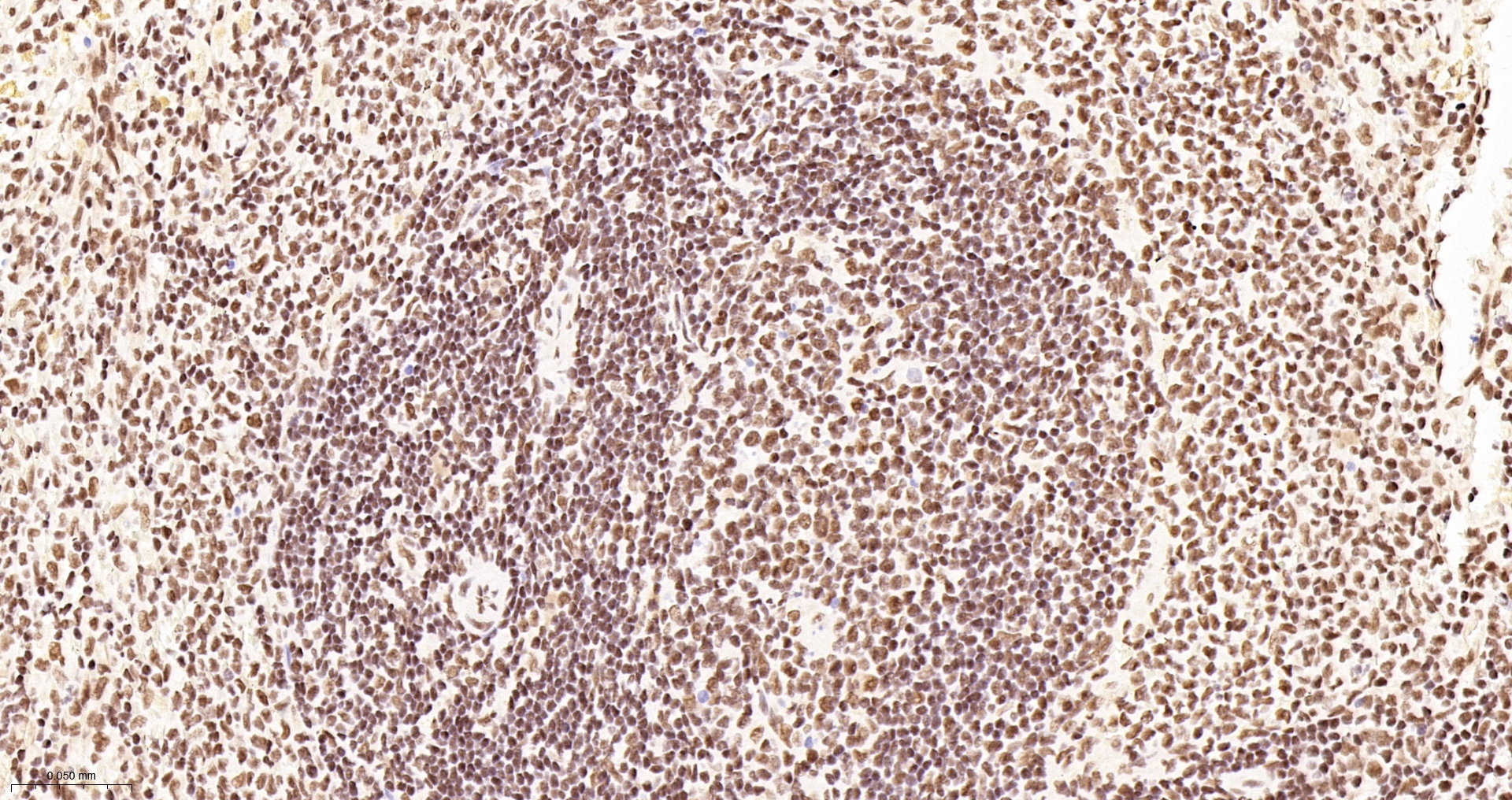 TBP Recombinant Antibody