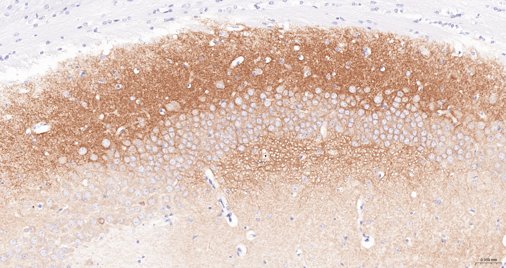 GluR1 Recombinant Antibody, Biotin Conjugated