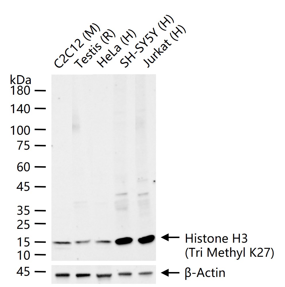 Histone H3 (Tri Methyl K27) Recombinant Antibody