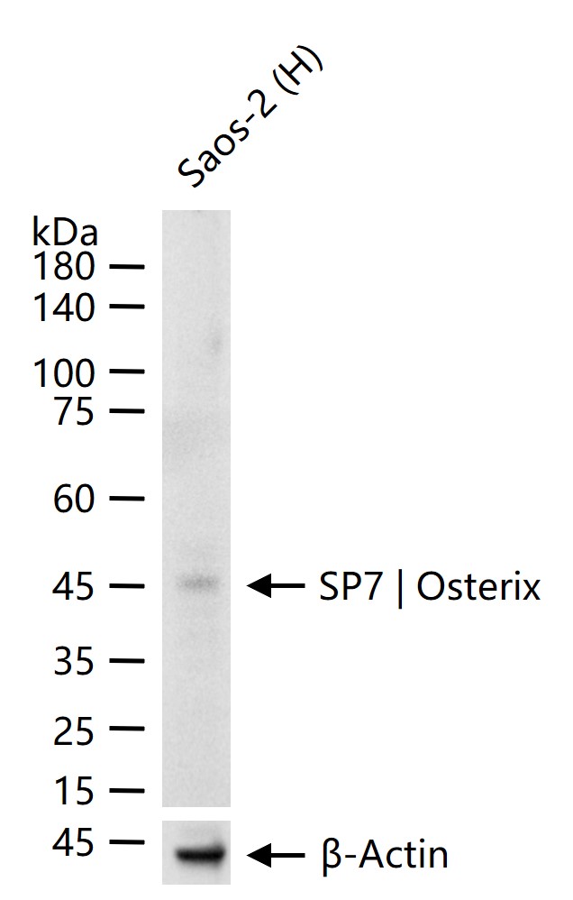 SP7 | Osterix Recombinant Antibody