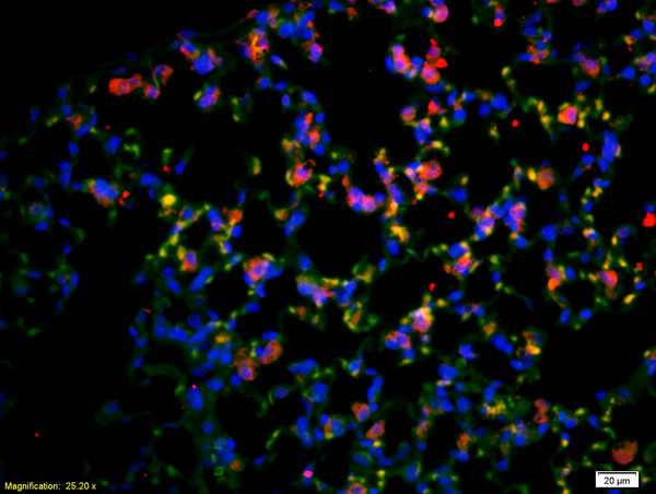 Formalin-fixed and paraffin-embedded rat lung labeled with Anti-CD4 Polyclonal Antibody, Unconjugated(bs-0647R) 1:200, overnight at 4\u00b0C, The secondary antibody was Goat Anti-Rabbit IgG, Cy3 conjugated(bs-0295G-Cy3)used at 1:200 dilution for 40 minutes at 37\u00b0C.