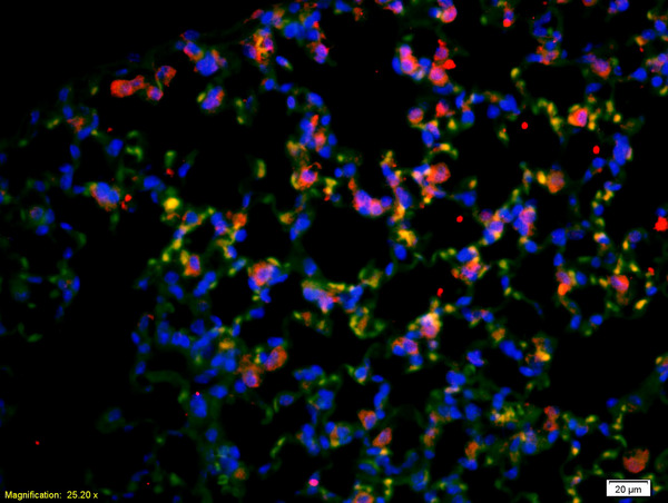 Formalin-fixed and paraffin-embedded rat lung labeled with Anti-CD4 Polyclonal Antibody, Unconjugated(bs-0647R) 1:200, overnight at 4°C, The secondary antibody was Goat Anti-Rabbit IgG, Cy3 conjugated(bs-0295G-Cy3)used at 1:200 dilution for 40 minutes at 37°C. Formalin-fixed and paraffin-embedded rat lung labeled with Anti-CD4 Polyclonal Antibody, Unconjugated(bs-0647R) 1:200, overnight at 4°C, The secondary antibody was Goat Anti-Rabbit IgG, Cy3 conjugated(bs-0295G-Cy3)used at 1:200 dilution for 40 minutes at 37°C.