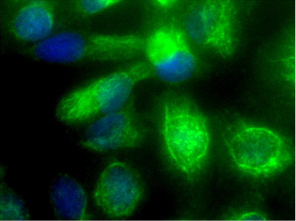 Image submitted by One World Lab validation program. U138 cells were stained with bs-0756R Rabbit Anti-Vimentin Polyclonal Antibody at 1:100 in PBS and incubated for one hour at room temperature, followed by secondary antibody incubation, DAPI staining and detection.