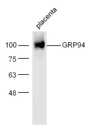 Mouse placenta lysates probed with Rabbit Anti-GRP94 Polyclonal Antibody, Unconjugated (bs-0194R) at 1:300 overnight at 4˚C. Followed by conjugation to secondary antibody (bs-0295G-HRP) at 1:500 for 90 min at 37˚C