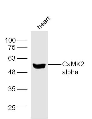 Mouse heart lysates probed with Rabbit Anti-CaMK2 Polyclonal Antibody, Unconjugated (bs-0771R) at 1:300 overnight at 4˚C. Followed by conjugation to secondary antibody (bs-0295G-HRP) at 1:500 for 90 min at 37˚C