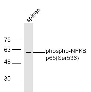 Mouse spleen lysates probed with Rabbit Anti-NFKB p65(Ser536) Polyclonal Antibody, Unconjugated (bs-0982R) at 1:300 overnight at 4˚C. Followed by conjugation to secondary antibody (bs-0295G-HRP) at 1:500 for 90 min at 37˚C