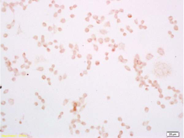 Mouse macrophages(RAW264.7)labeled with Rabbit Anti TLR4/CD284 Polyclonal Antibody, Unconjugated (bs-1021R) at 1:200 followed by conjugation to the secondary antibody and DAB staining