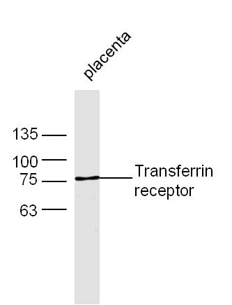 Mouse placenta lysates probed with Rabbit Anti-Transferrin receptor Polyclonal Antibody, Unconjugated (bs-0988R) at 1:300 overnight at 4˚C. Followed by conjugation to secondary antibody (bs-0295G-HRP) at 1:500 for 90 min at 37˚C