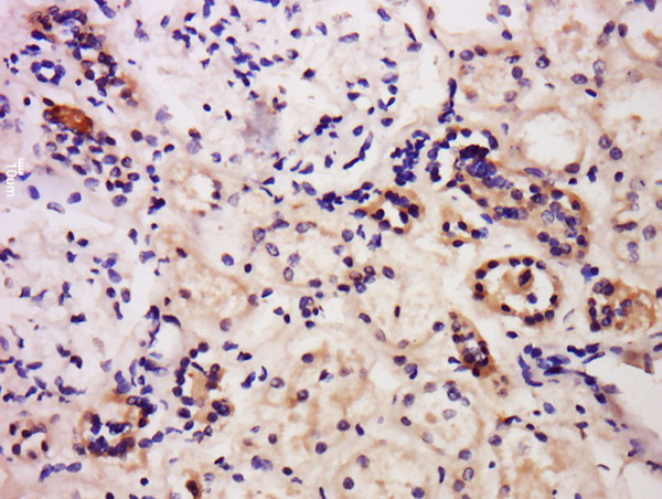 Formalin-fixed and paraffin embedded human kidney labeled with Anti-Caspase-6 Polyclonal Antibody, Unconjugated (bs-0151R) at 1:200 followed by conjugation to the secondary antibody and DAB staining.