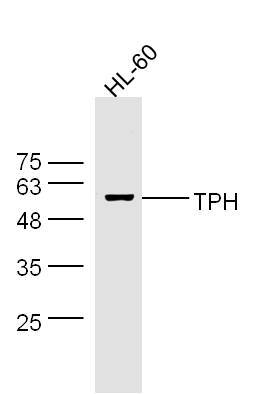 HL-60 cell lysates probed with Rabbit Anti-Trptophan Hydroxylase Polyclonal Antibody, Unconjugated (bs-1215R) at 1:300 overnight at 4˚C. Followed by conjugation to secondary antibody (bs-0295G-HRP) at 1:500 for 90 min at 37˚C.