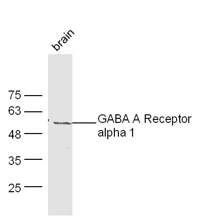 Mouse brain lysates probed with Rabbit Anti-GABA A Receptor alpha 1 Polyclonal Antibody, Unconjugated (bs-1232R) at 1:300 overnight at 4˚C. Followed by conjugation to secondary antibody (bs-0295G-HRP) at 1:500 for 90 min at 37˚C.