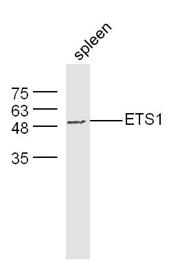 Mouse spleen lysates probed with Rabbit Anti-ETS1 Polyclonal Antibody, Unconjugated (bs-1285R) at 1:300 overnight at 4˚C. Followed by conjugation to secondary antibody (bs-0295G-HRP) at 1:500 for 90 min at 37˚C.