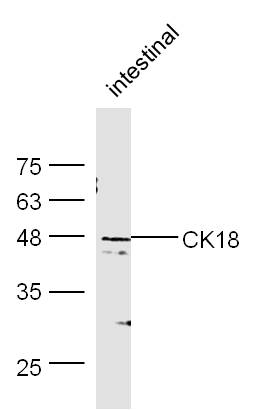 Moust intestine lysates probed with Rabbit Anti-CK18 Polyclonal Antibody, Unconjugated (bs-1339R) at 1:300 overnight at 4˚C. Followed by conjugation to secondary antibody (bs-0295G-HRP) at 1:500 for 90 min at 37˚C.