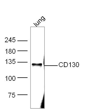 Mouse lung lysates probed with IL-6R Beta/CD130/gp130 Antibody, Unconjugated (bs-1459R) at 1:300 overnight at 4˚C. Followed by conjugation to secondary antibody (bs-0295G-HRP) at 1:500 for 90 min at 37˚C.