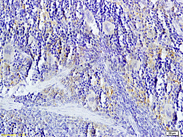 Formalin-fixed and paraffin-embedded: rat spleen tissue labeled with Rabbit Anti-TNFSF14 Polyclonal Antibody, Unconjugated (bs-2462R) 1:200 followed by conjugation to the secondary antibody and DAB staining
