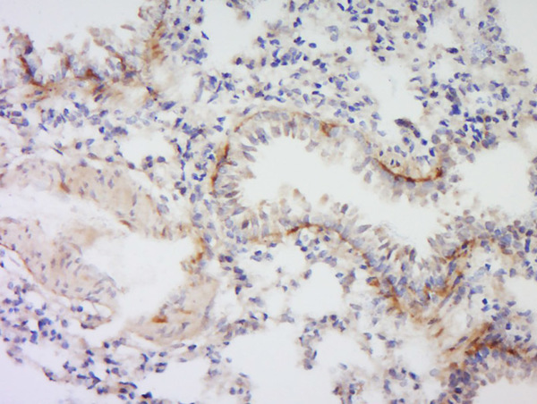 Formalin-fixed and paraffin embedded rat lung labeled with Anti- VSIG4 Polyclonal Antibody, Unconjugated (bs-0479R) at 1:300 followed by conjugation to the secondary antibody and DAB staining.