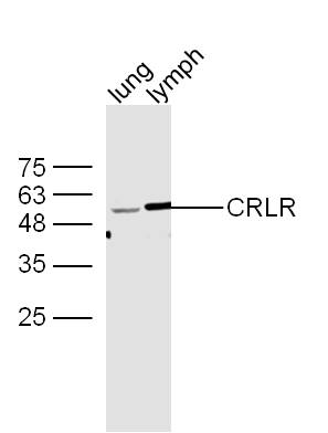 Mouse lung and lymph node lysates probed with Rabbit Anti-CRLR\/CGRPR1 Polyclonal Antibody, Unconjugated (bs-1860R) at 1:300 overnight at 4˚C. Followed by conjugation to secondary antibody (bs-0295G-HRP) at 1:500 for 90 min at 37˚C.