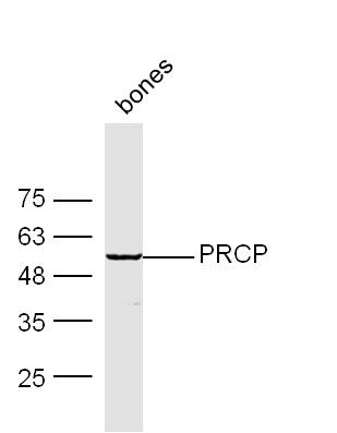 Mouse bone lysates probed with Rabbit Anti-PRCP Polyclonal Antibody, Unconjugated (bs-1873R) at 1:300 overnight at 4˚C. Followed by conjugation to secondary antibody (bs-0295G-HRP) at 1:500 for 90 min at 37˚C.