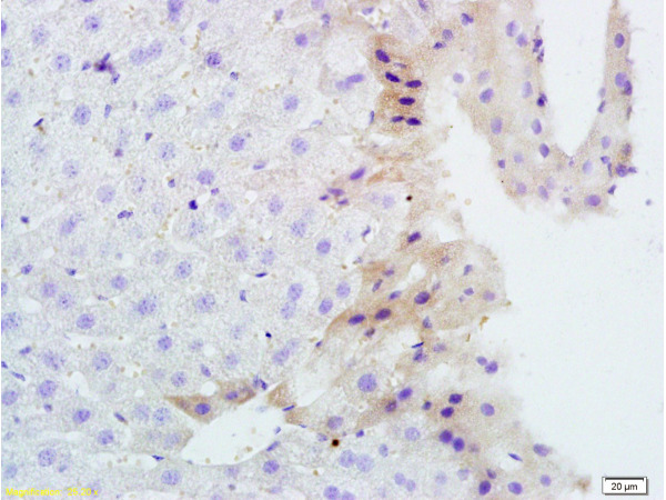 Formalin-fixed and paraffin-embedded mouse liver tissue labeled with Rabbit Anti-TNFSF14 Polyclonal Antibody, Unconjugated (bs-2462R) 1:200 followed by conjugation to the secondary antibody and DAB staining