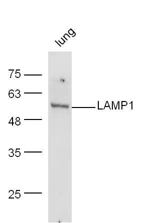 Mouse lung lysates probed with Rabbit Anti-LAMP-1 Polyclonal Antibody, Unconjugated (bs-1970R) at 1:300 overnight at 4˚C. Followed by conjugation to secondary antibody (bs-0295G-HRP) at 1:500 for 90 min at 37˚C.